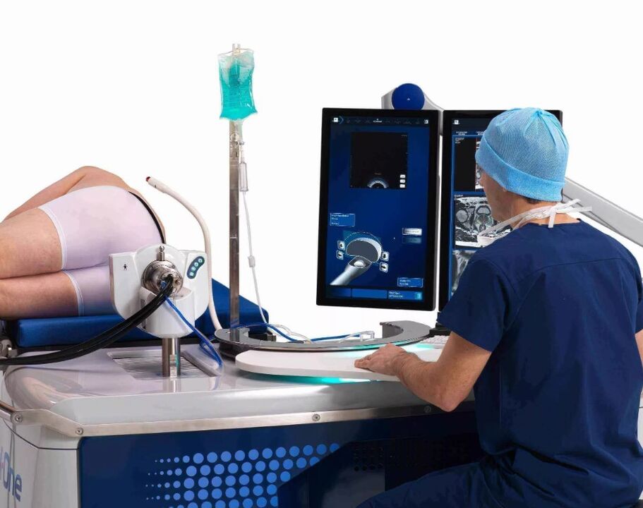 A prosztata ultrahangvizsgálata